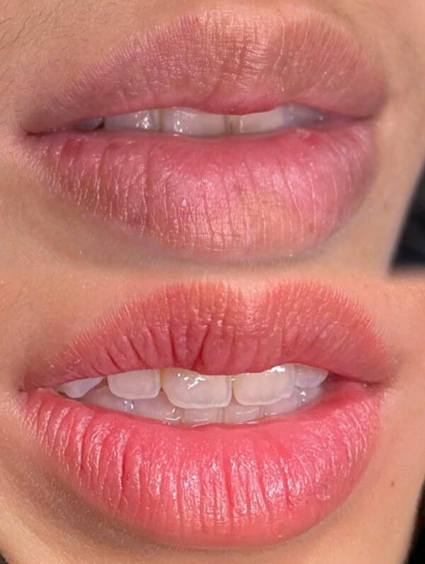 Khử thâm phủ hồng môi - Ảnh 4